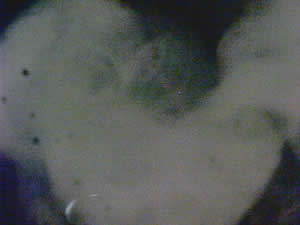 heart